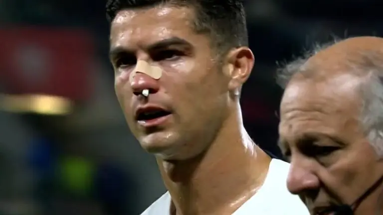 Cristiano Ronaldo Recibe Fuerte Golpe En La Nariz Tudn F Tbol Tudn