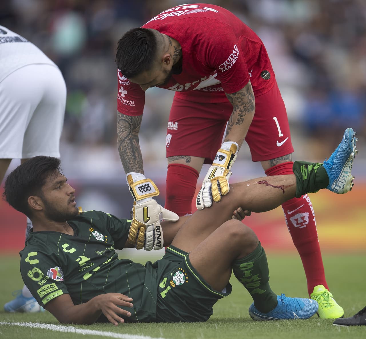 Eduardo Aguirre sufrió un duro golpe con el poste y terminó con una cortada en la pierna.