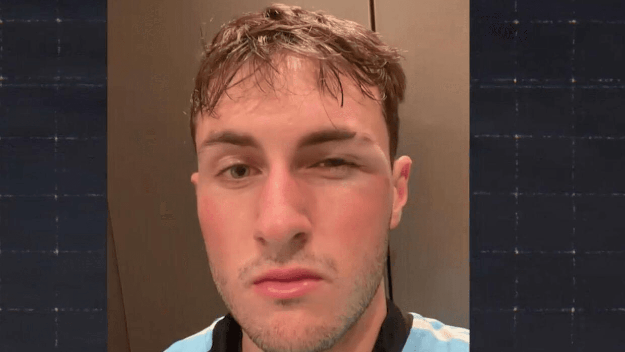 ¿Canelo? Giménez bromea sobre su ojo morado: "Fue por defender a Messi"