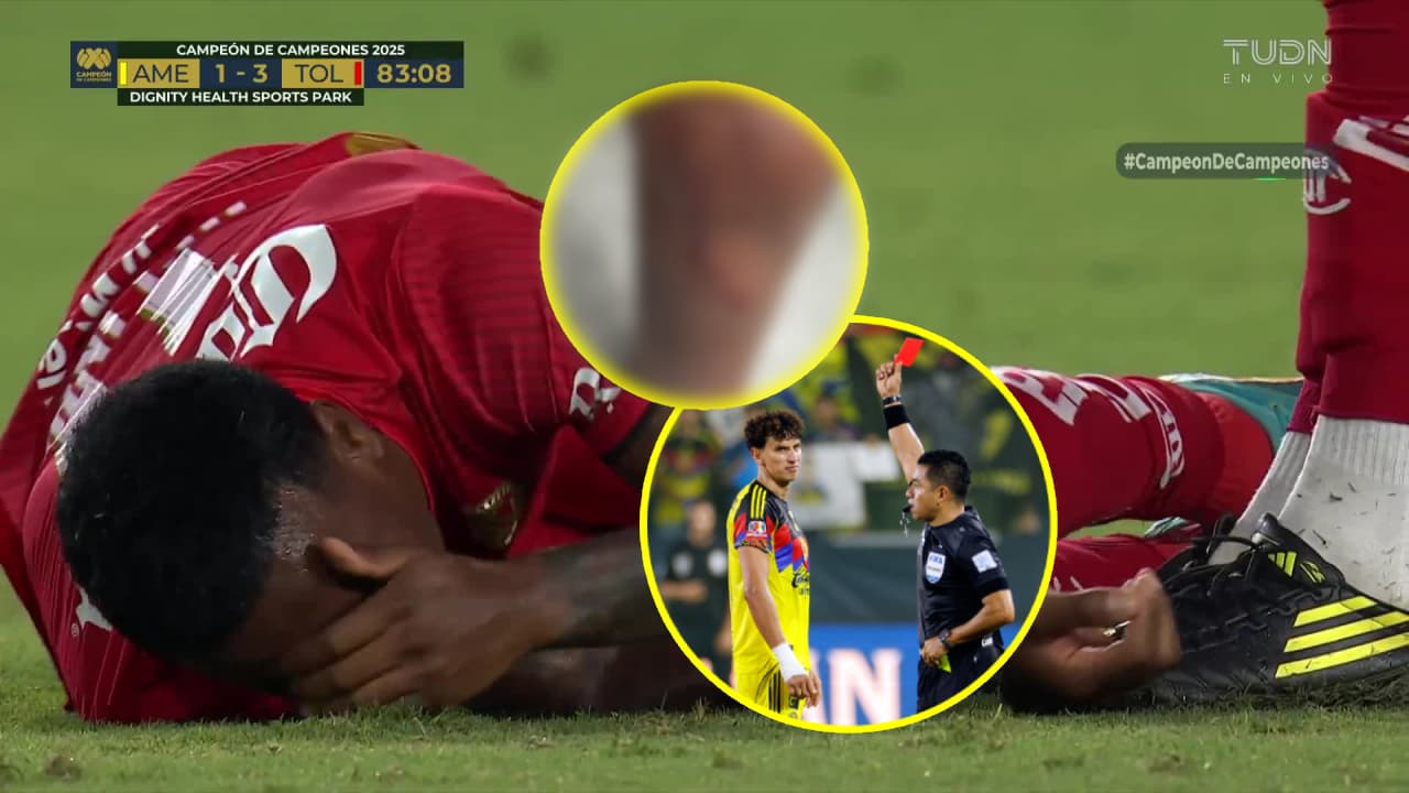 Helinho muestra su herida tras dura entrada de Lichnovsky en el Campeón de Campeones