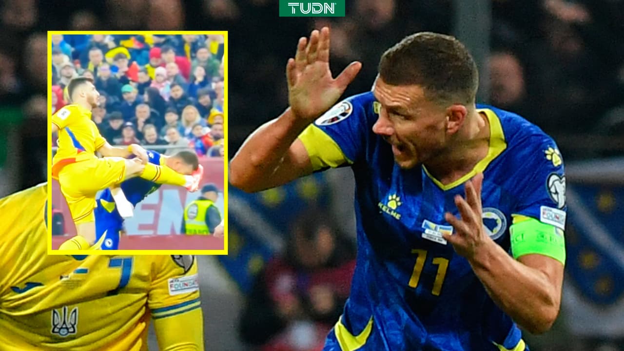 ¡Escalofriante! Así quedó el rostro de Dzeko tras recibir una patada