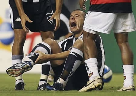 Luciano Almeida: el jugador del Botafogo sufrió una impactante fractura en la pierna derecha que lo marginó seis meses de las canchas.