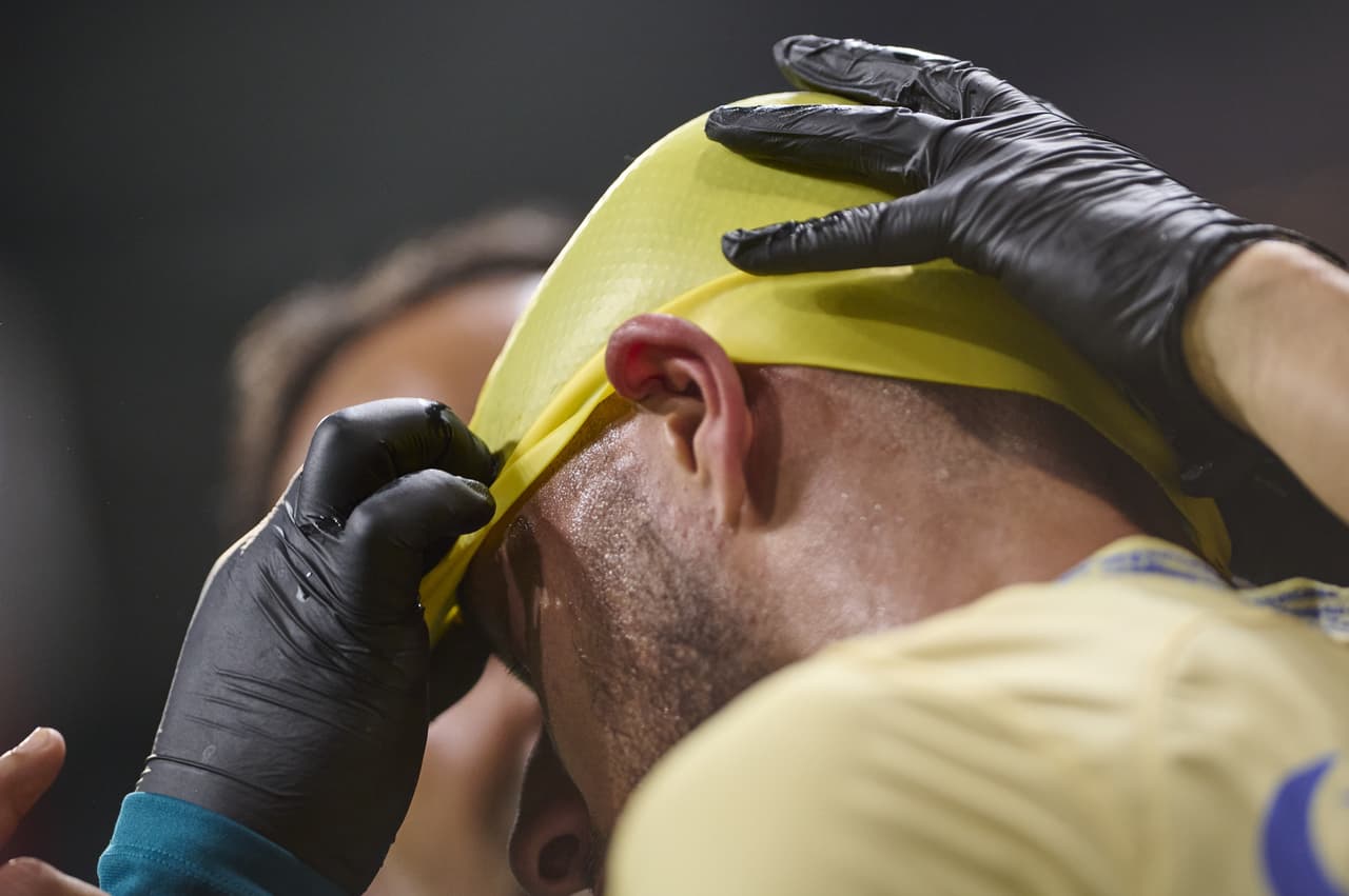 Por Rayados anotaron Stefan Medina, Mexi Meza y Rodrigo Aguirre; por el América 'Cabecita' Rodríguez y Alejandro Zendejas.